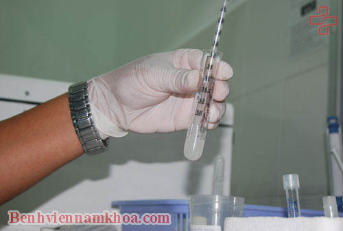 Cách nhận biết tinh trùng loãng hay đặc