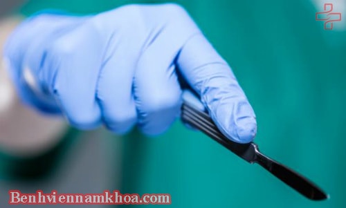 Cắt bao quy đầu ở bệnh viện nào
