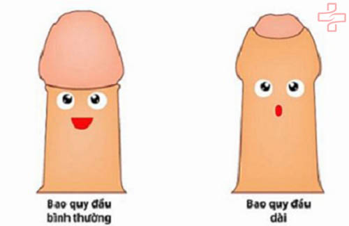 Địa chỉ cắt bao quy đầu 2