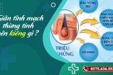 Bị giãn tĩnh mạch thừng tinh bạn nên kiêng gì?