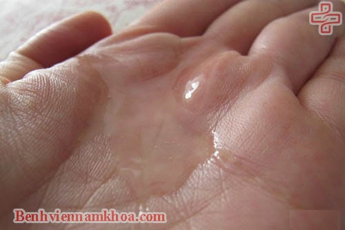 Tinh trùng loãng màu trắng trong
