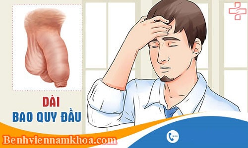 Hình ảnh dài bao quy đầu