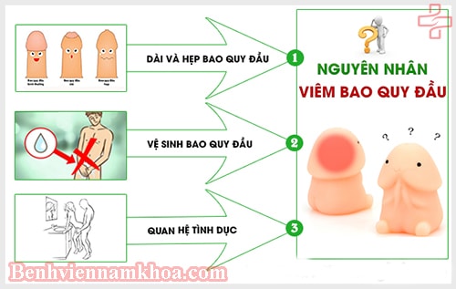 nguyên nhân viêm bao quy đầu