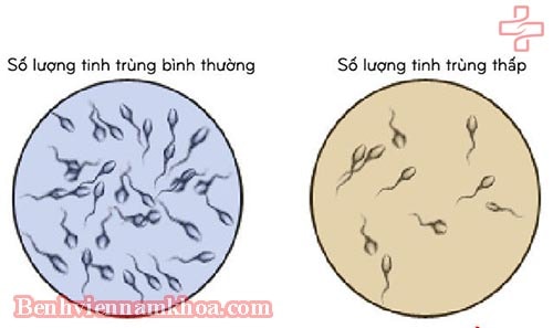 Cách nhận biết tinh trùng loãng