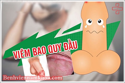 viêm bao quy đầu ở nam giới