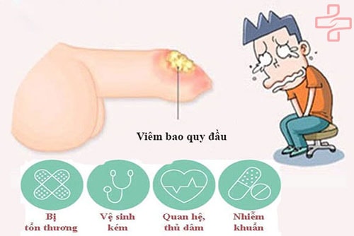 Viêm bao quy đầu và những điều bạn cần biết