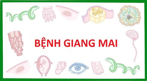 Bệnh giang mai là gì