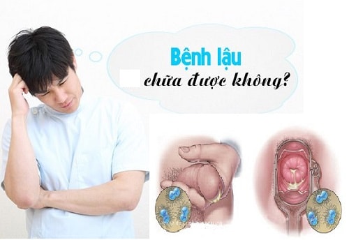 Bệnh lậu được chữa khỏi hoàn toàn 100% nếu được phát hiện và điều trị sớm 