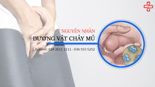 dương vật chảy mủ