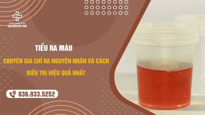 Các cây thuốc nam chữa viêm tuyến tiền liệt
