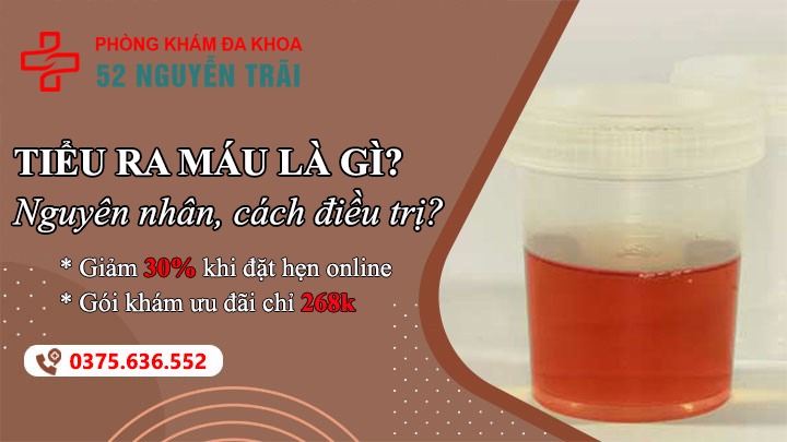 Tiểu ra máu cảnh báo gì? Nguyên nhân và cách điều trị hiệu quả