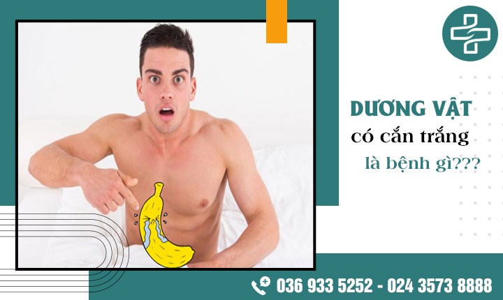 Dương vật có cặn trắng có phải dấu hiệu của bệnh lý không?