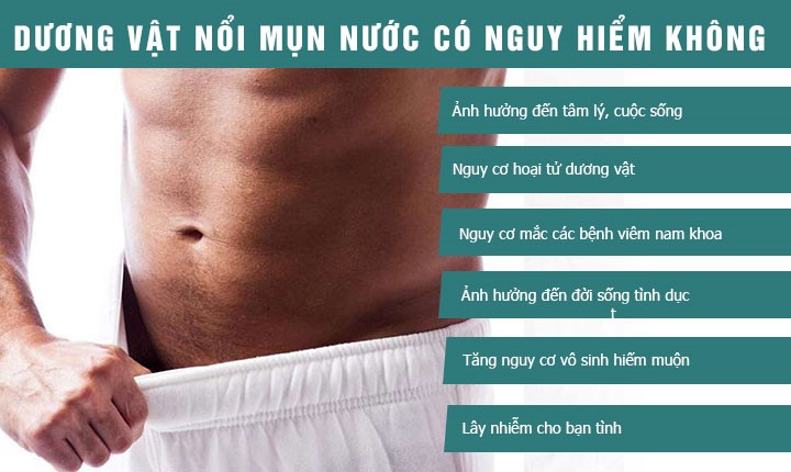 DƯƠNG VẬT NỔI MỤN NƯỚC CÓ NGUY HIỂM KHÔNG?