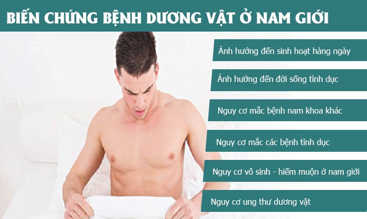 BỆNH VỀ DƯƠNG VẬT CÓ NGUY HIỂM KHÔNG?