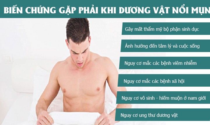 DẤU HIỆU NHẬN BIẾT DƯƠNG VẬT NỔI MỤN TRẮNG NHƯ THẾ NÀO?