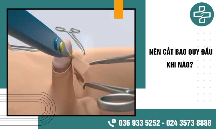 Nên cắt bao quy đầu khi nào: 4 Trường hợp nhất định phải cắt bao quy đầu ngay