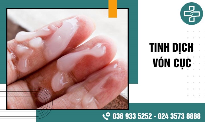 Tinh dịch vón cục: Những hiểm họa không ngờ vì không điều trị sớm!
