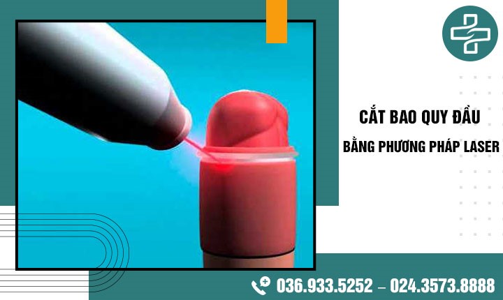 Cắt bao quy đầu bằng phương pháp Laser với 3 không: Không đau – Không để lại sẹo – Không tốn kém