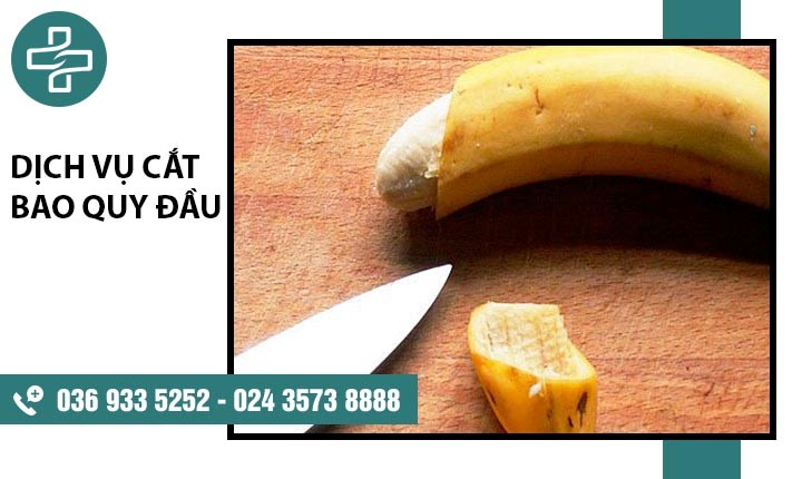 [Tìm hiểu] Dịch vụ cắt bao quy đầu không đau – thẩm mĩ – chi phí thấp