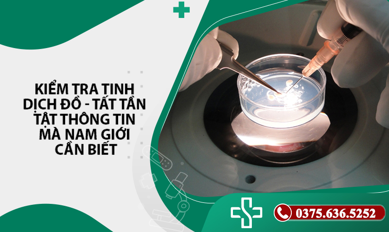 kiểm tra tinh dịch đồ nam giới