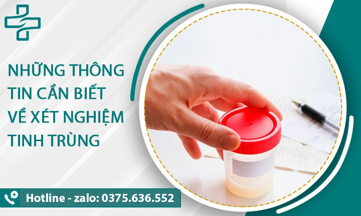 những thông tin cần biết khi xét nghiệm tinh dịch đồ