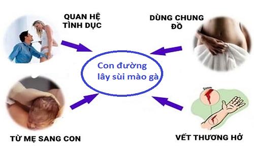 bệnh sùi mào gà lây qua đâu ?