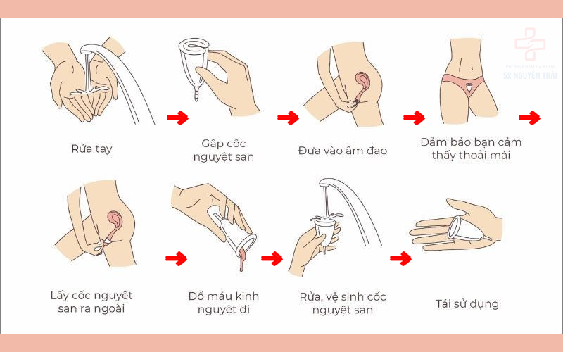 sử dụng cốc nguyệt san đúng cách