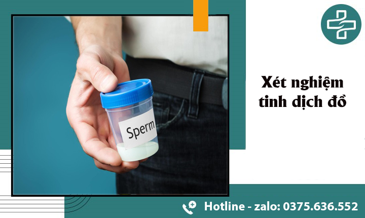 xét nghiệm tinh dịch đồ