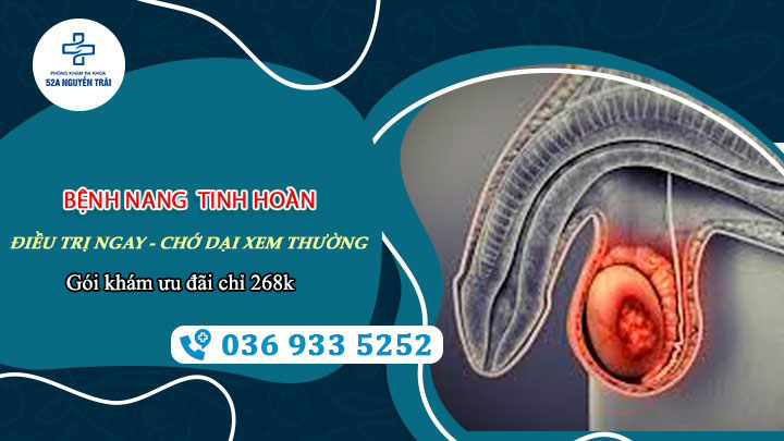 Bệnh nang tinh hoàn: Điều trị ngay - Chớ dại mà xem thường!