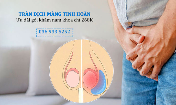 Bệnh tràn dịch màng tinh hoàn: Thông tin chia sẻ từ chuyên gia nhất định không được bỏ qua