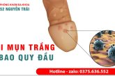 MỤN TRẮNG Ở BAO QUY ĐẦU CẢNH BÁO BỆNH GÌ ?