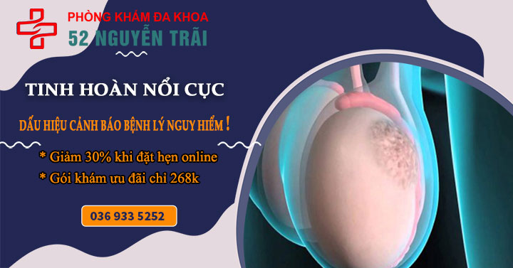 Tinh hoàn nổi cục cứng dấu hiệu cảnh báo bệnh gì?