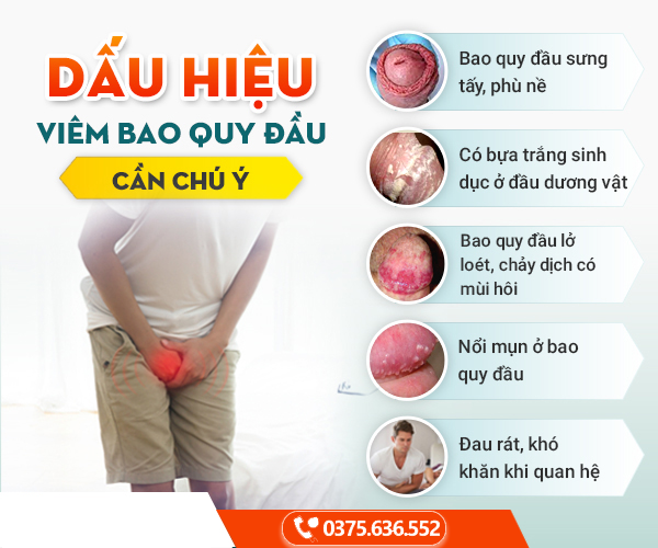 Đầu dương vật sưng đỏ, ngứa, đau rát có thể là viêm bao quy đầu Đầu dương vật sưng đỏ là do viêm bao quy đầu