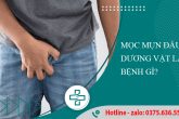 Mọc mụn ở đầu dương vật cảnh báo 4 căn bệnh nguy hiểm phái mạnh?