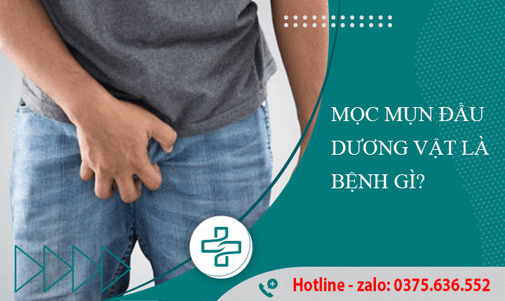 Mọc mụn ở đầu dương vật là bị bệnh gì ? Mọc mụn ở đầu dương vật là bị bệnh gì ?