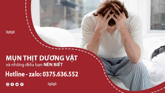 Mụn thịt dương vật