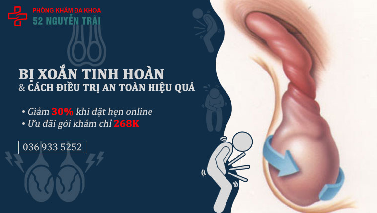 Nhận biết bệnh xoắn tinh hoàn và cách điều trị an toàn, hiệu quả