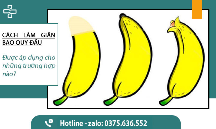 Cách làm giãn bao quy đầu hẹp