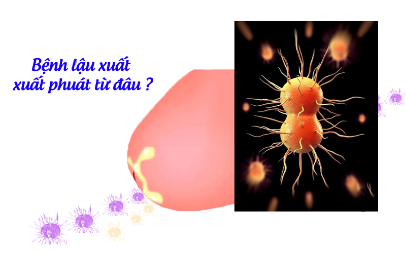 bệnh lậu xuất phát từ đâu