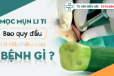 MỤN LI TI Ở BAO QUY ĐẦU LÀ DẤU HIỆU CỦA BỆNH GÌ ?