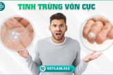 Tinh trùng vón cục do đâu? Có gây vô sinh không?