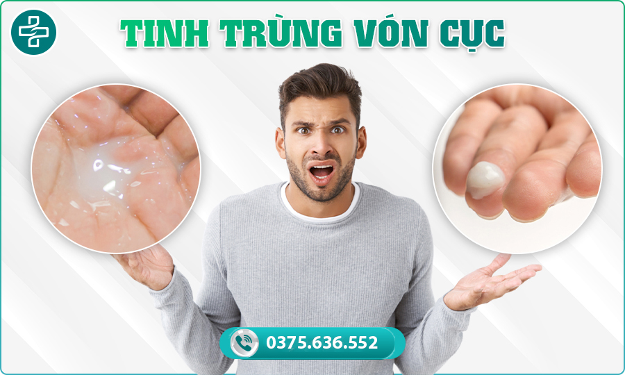 Tinh trùng vón cục