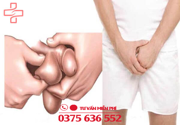 Bị ngứa rát ở bìu nguyên nhân do đâu