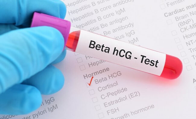 beta hcg