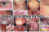 Các bệnh xã hội phổ biến bạn nên biết cách phòng tránh