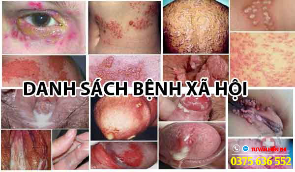 bệnh xã hội là gì ?