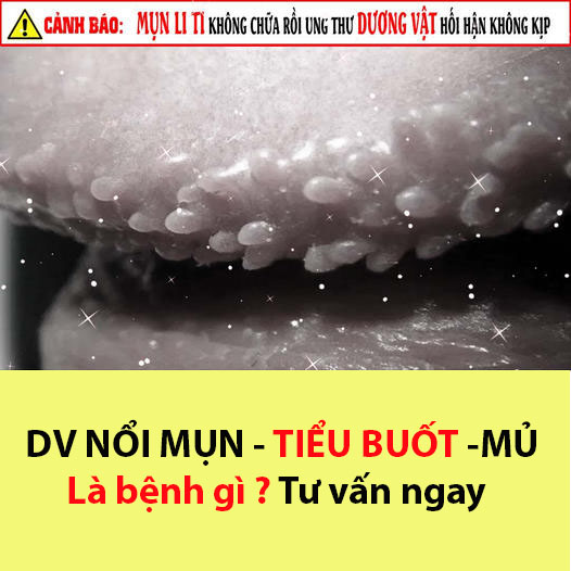 Dương vật nổi mụn, ngứa sau khi quan hệ