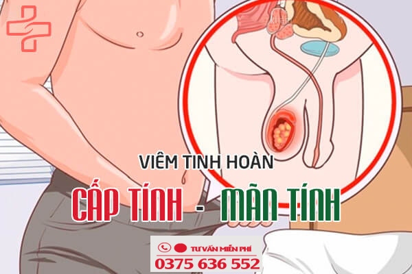 viêm tinh hoàn
