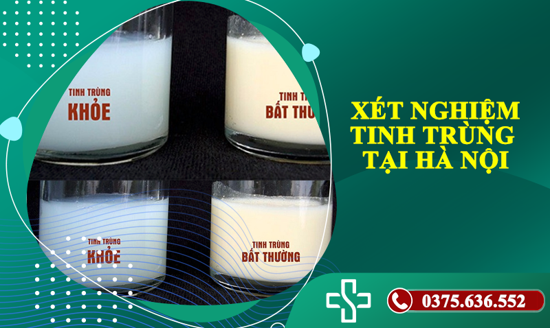 xét nghiệm tinh trùng tại Hà Nội