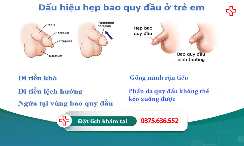 dấu hiệu trẻ bị hẹp bao quy đầu
